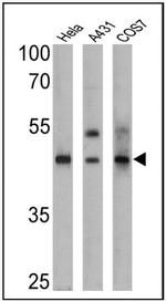 Cytokeratin 15 Antibody in Western Blot (WB)