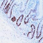 PCNA Antibody in Immunohistochemistry (Paraffin) (IHC (P))