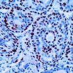 PCNA Antibody in Immunohistochemistry (Paraffin) (IHC (P))