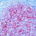 VCAM-1 Antibody in Immunohistochemistry (Paraffin) (IHC (P))