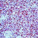 Myogenin Antibody in Immunohistochemistry (Paraffin) (IHC (P))