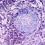 CD45RO Antibody in Immunohistochemistry (Paraffin) (IHC (P))