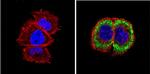 Alpha-Smooth Muscle Actin Antibody in Immunocytochemistry (ICC/IF)