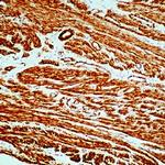 Alpha-Smooth Muscle Actin Antibody in Immunohistochemistry (Paraffin) (IHC (P))