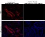 CD56 Antibody