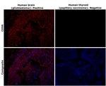 CD56 Antibody