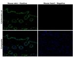 Cytokeratin 14 Antibody in Immunohistochemistry (Paraffin) (IHC (P))