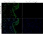 Cytokeratin 14 Antibody in Immunohistochemistry (Paraffin) (IHC (P))