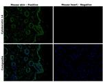 Cytokeratin 14 Antibody in Immunohistochemistry (Paraffin) (IHC (P))