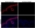 Cytokeratin 14 Antibody in Immunohistochemistry (Paraffin) (IHC (P))