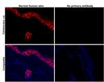 Cytokeratin 14 Antibody in Immunohistochemistry (Paraffin) (IHC (P))