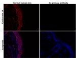 Cytokeratin 14 Antibody in Immunohistochemistry (Paraffin) (IHC (P))