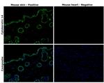 Cytokeratin 14 Antibody