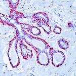 Calponin 1 Antibody in Immunohistochemistry (Paraffin) (IHC (P))