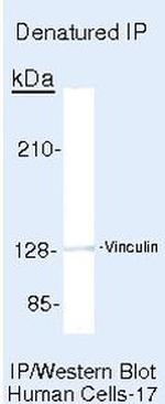 Vinculin Antibody in Immunoprecipitation (IP)