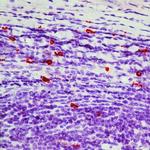 Mast Cell Chymase Antibody in Immunohistochemistry (Paraffin) (IHC (P))