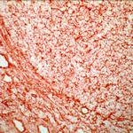 HLA-ABC Antibody in Immunohistochemistry (Frozen) (IHC (F))