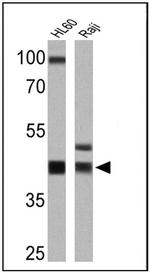 HLA-ABC Antibody in Western Blot (WB)