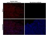 Bcl-2 Antibody in Immunohistochemistry (Paraffin) (IHC (P))