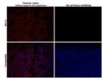 Bcl-2 Antibody in Immunohistochemistry (Paraffin) (IHC (P))