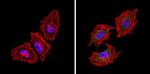 Bcl-2 Antibody in Immunocytochemistry (ICC/IF)