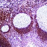 Bcl-2 Antibody in Immunohistochemistry (Paraffin) (IHC (P))