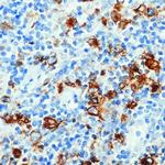 CD15 Antibody in Immunohistochemistry (Paraffin) (IHC (P))