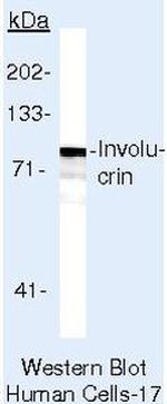 Involucrin Antibody in Western Blot (WB)