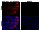 Vimentin Antibody in Immunohistochemistry (Paraffin) (IHC (P))