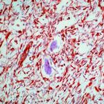 Vimentin Antibody in Immunohistochemistry (Paraffin) (IHC (P))