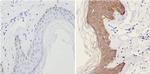 Cytokeratin HMW Antibody in Immunohistochemistry (Paraffin) (IHC (P))