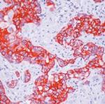 Cytokeratin HMW Antibody in Immunohistochemistry (Paraffin) (IHC (P))