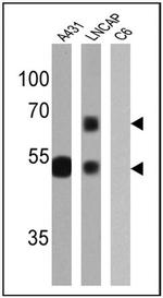 Cytokeratin HMW Antibody in Western Blot (WB)