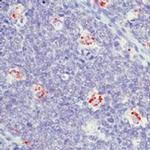 Epstein Barr Virus Antibody in Immunohistochemistry (Paraffin) (IHC (P))