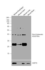 Cytokeratin Pan Antibody in Western Blot (WB)