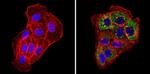 Cytokeratin Pan Antibody in Immunocytochemistry (ICC/IF)