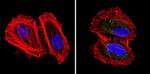 Cytokeratin Pan Antibody in Immunocytochemistry (ICC/IF)