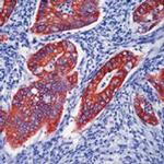 Cytokeratin Pan Antibody in Immunohistochemistry (Paraffin) (IHC (P))