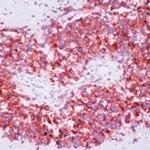 CD99 Antibody in Immunohistochemistry (Paraffin) (IHC (P))