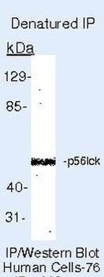 LCK Antibody in Immunoprecipitation (IP)