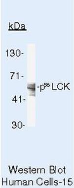 LCK Antibody in Western Blot (WB)