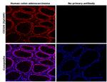 EpCAM Antibody in Immunohistochemistry (Paraffin) (IHC (P))