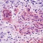 EpCAM Antibody in Immunohistochemistry (Paraffin) (IHC (P))