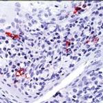 CD1a Antibody in Immunohistochemistry (Paraffin) (IHC (P))