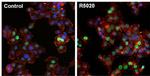 Progesterone Receptor Antibody