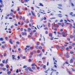 Cytokeratin 5 Antibody in Immunohistochemistry (Paraffin) (IHC (P))