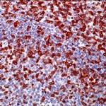 Zap-70 Antibody in Immunohistochemistry (Paraffin) (IHC (P))