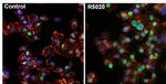 Progesterone Receptor Antibody