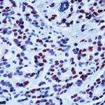 Progesterone Receptor Antibody in Immunohistochemistry (Paraffin) (IHC (P))