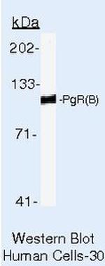 Progesterone Receptor Antibody in Western Blot (WB)